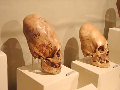 Вытянутые черепа Паракаса